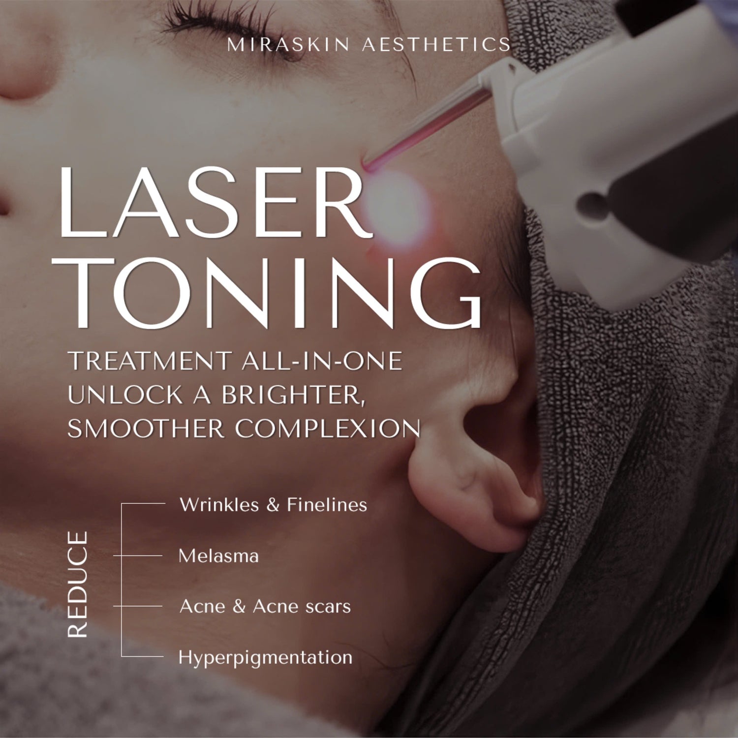 Face Laser Resurfacing