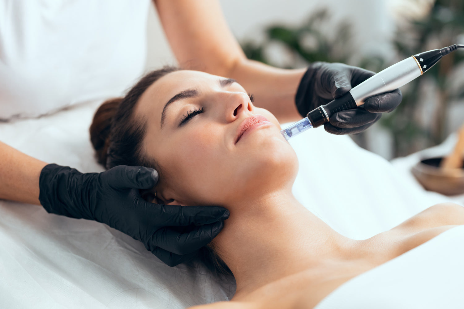 Microneedling Services