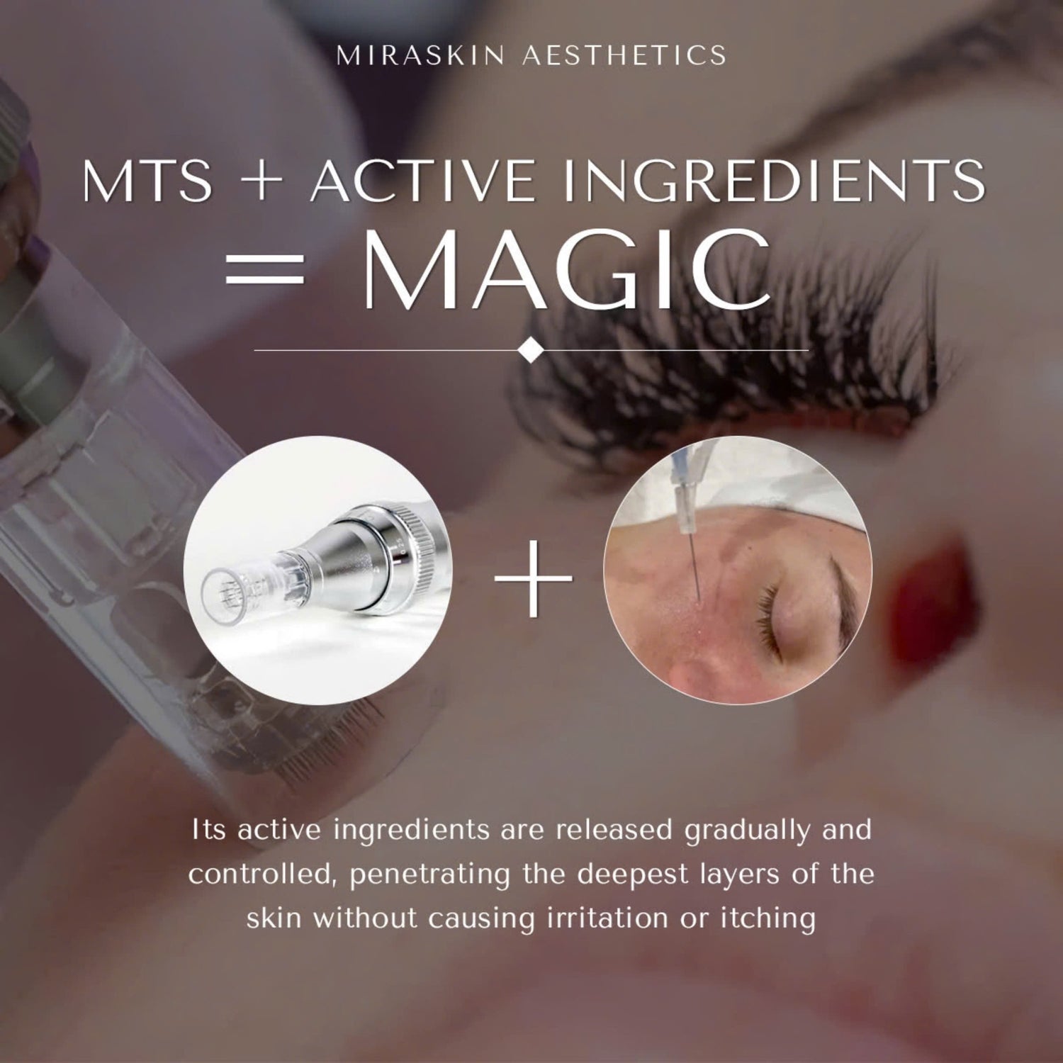 MTS Microneedling